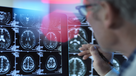 Infections urinaires et risque accru de démence