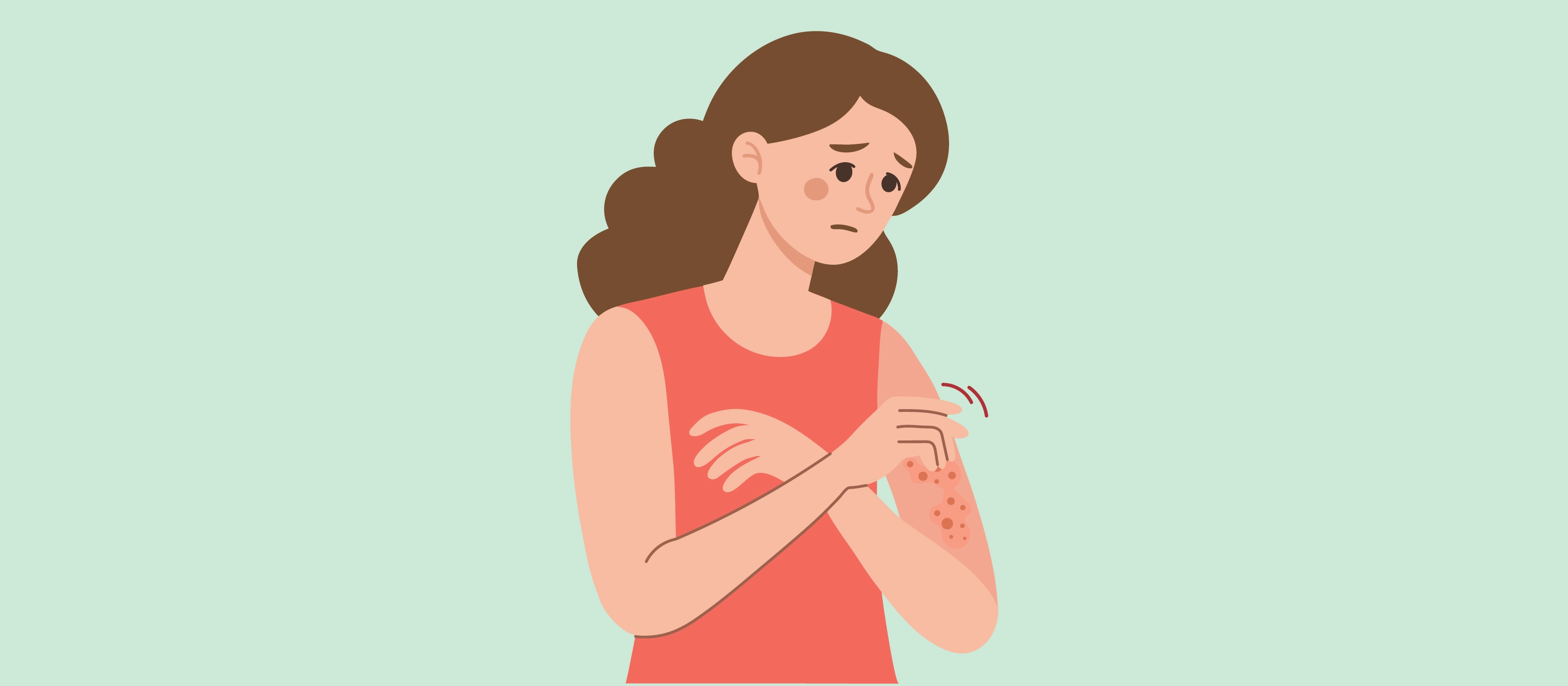 انسحاب الستيرويد الموضعي: حالة جلدية غامضة في بريطانيا