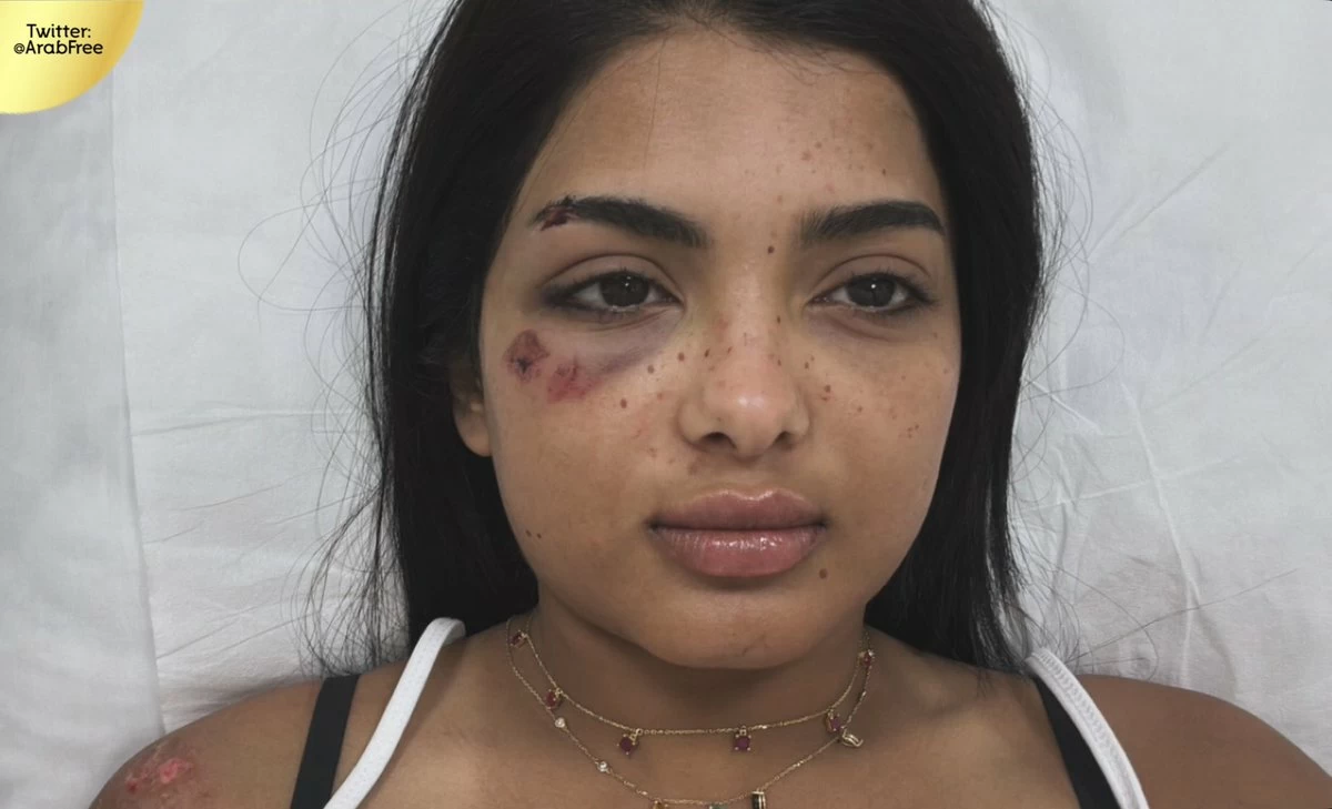 جود السفياني تطمئن جمهورها بعد حادث مروري