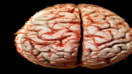 Gap Between AI and Human Brain in Computer Vision