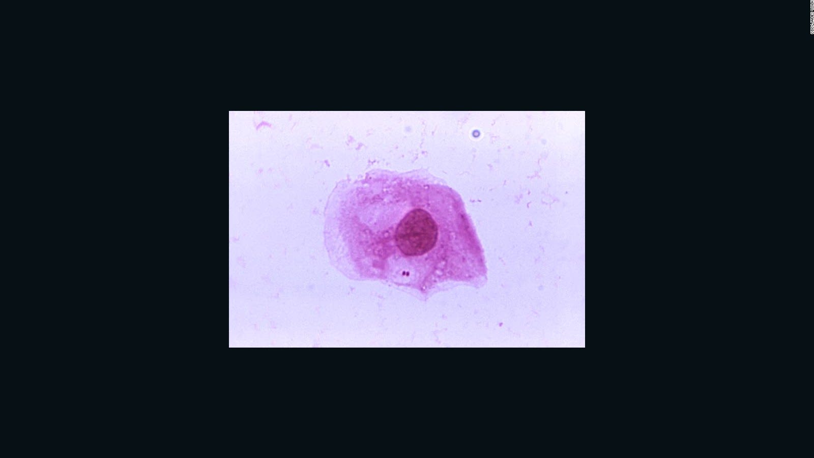 NHS Delays Reporting Meningitis Outbreak Concerns