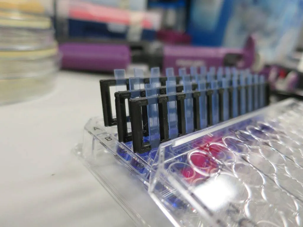 Test rapide pour traiter les infections urinaires