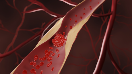 Warnungen vor Diät, die schädliches Cholesterin erhöht