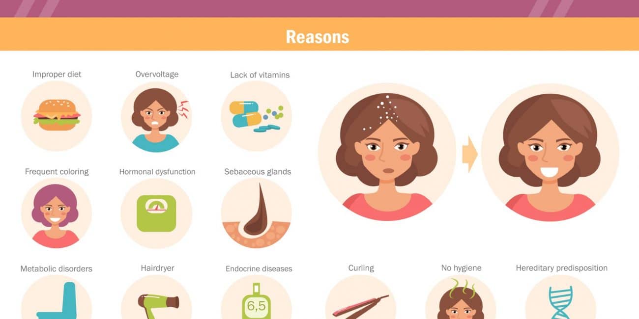 علاج قشرة الرأس في المنزل بطرق طبيعية