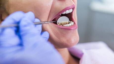 نزيف اللثة وتأثيره على صحة القلب