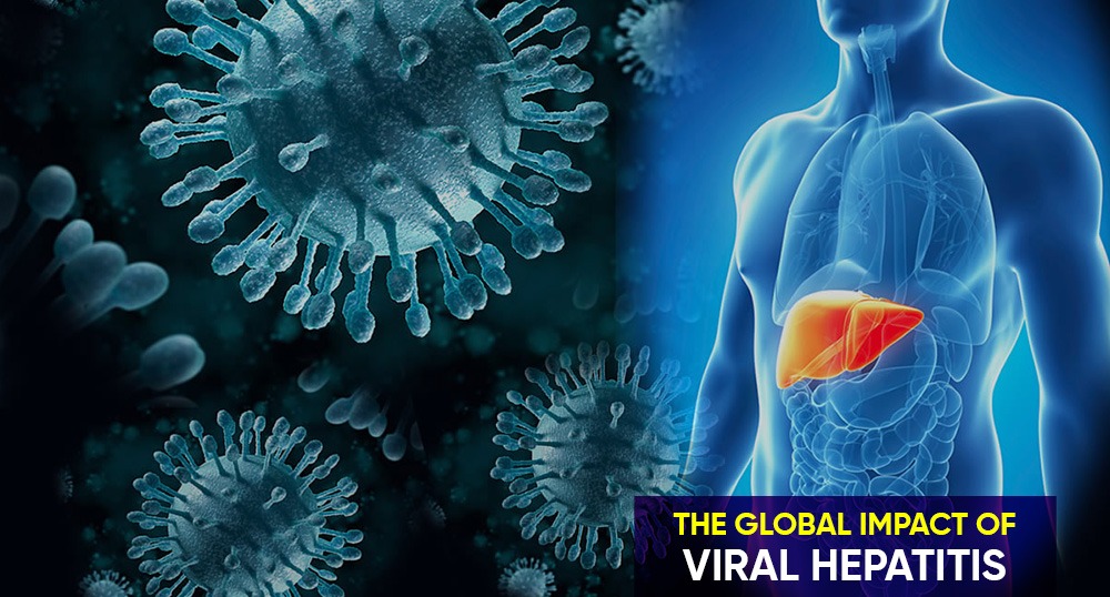التهاب الكبد الفيروسي: تحدٍ صحي عالمي مستمر