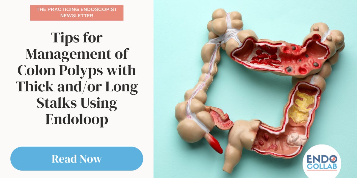 إرشادات صحية للتعايش مع القولون العصبي