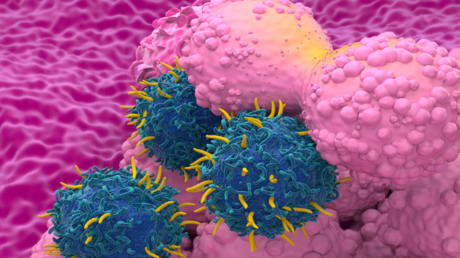 Nouvelle méthode pour traiter le cancer du sein efficacement