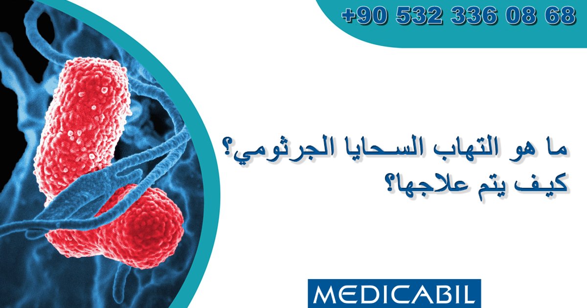 การระบาดของโรคเยื่อหุ้มสมองอักเสบในแคนเทอร์เบอรี