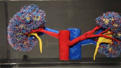 أطعمة تسبب حصى المسالك البولية وكيفية تجنبها