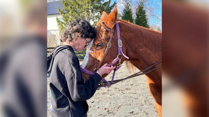 حروق سارة بسيسو: قصة كفاح فلسطينية