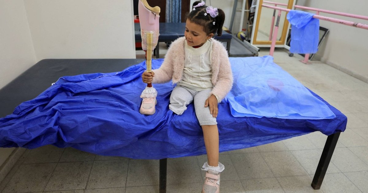 Inspiring Stories from Gaza: Life Challenges After Amputation