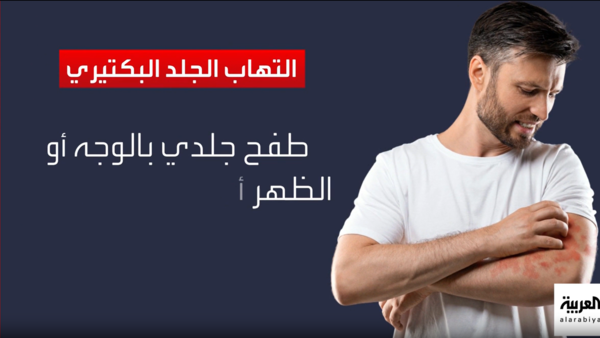 ਕੀਵਟ ਵਿੱਚ ਸੁਜ਼ਾਕ ਦਾ ਫੈਲਾਣਾ: ਪੱਤਰਕਾਰਤਾ ਅਤੇ ਜਾਣਕਾਰੀ