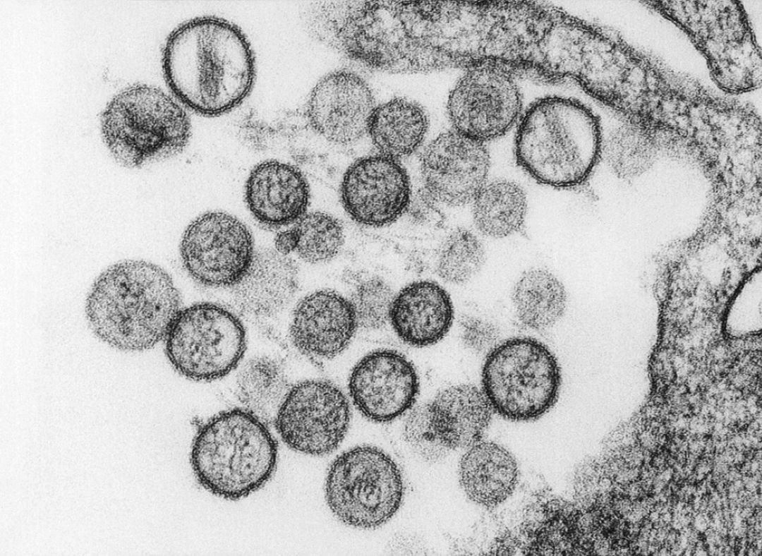 Évacuation des passagers d'un bateau de croisière à cause du Hantavirus