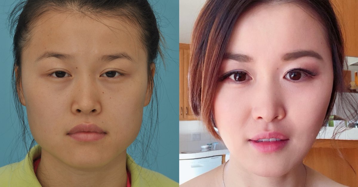 Modrić unterzieht sich einer Operation vor der Weltmeisterschaft