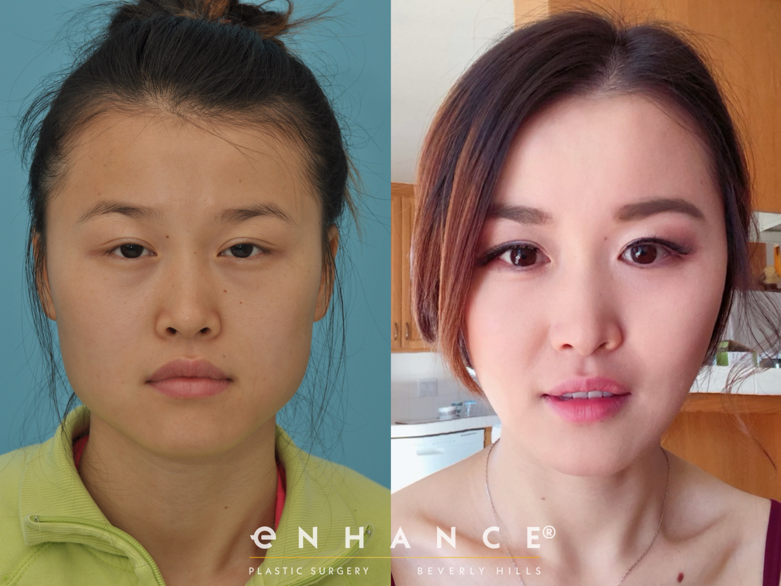 مودريتش يخضع لجراحة قبل كأس العالم