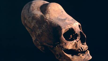 DNA Analysis and the Mysterious Paracas Skulls
