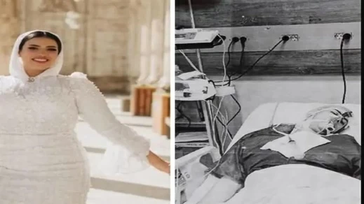 مأساة عروس حلوان: حقن تجميلية تنتهي بكارثة