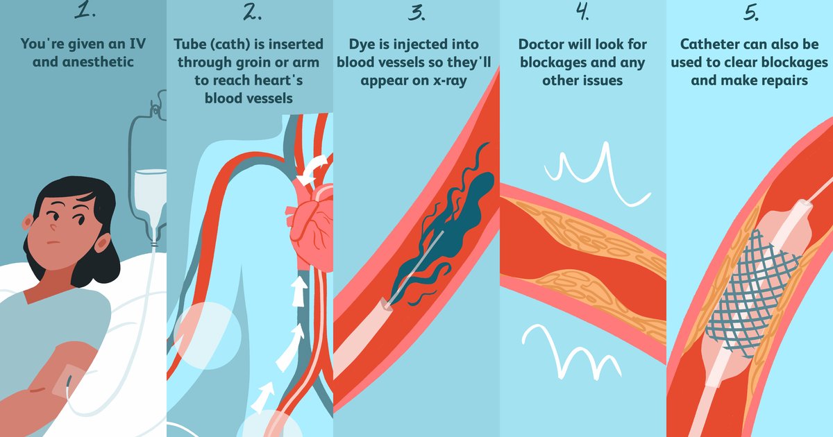 Alerte sur les risques d'une goutte d'air dans l'artère coronaire