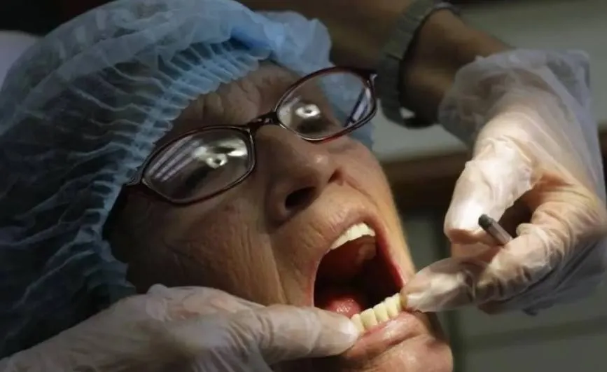 دراسة تربط بكتيريا الفم بسرطان المعدة