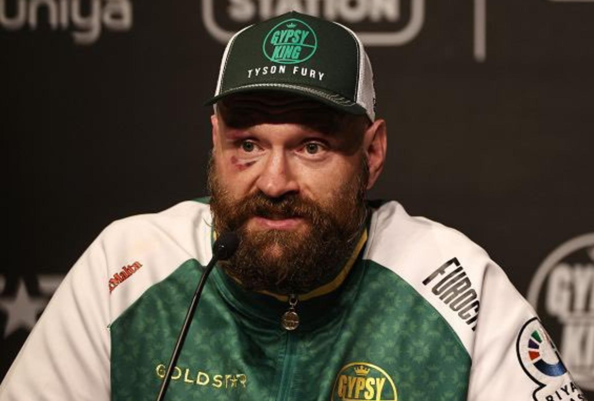 تايسون فيوري يكشف عن خططه للملاكمة في 2026