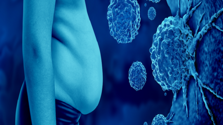 Obesity and Cancer: German Study Reveals Connection
