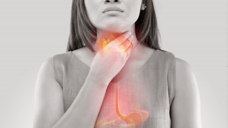 نصائح للتخفيف من حرقة المعدة