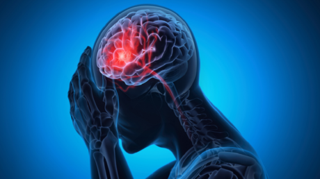 تأثير السكتة الدماغية على الذاكرة والخرف