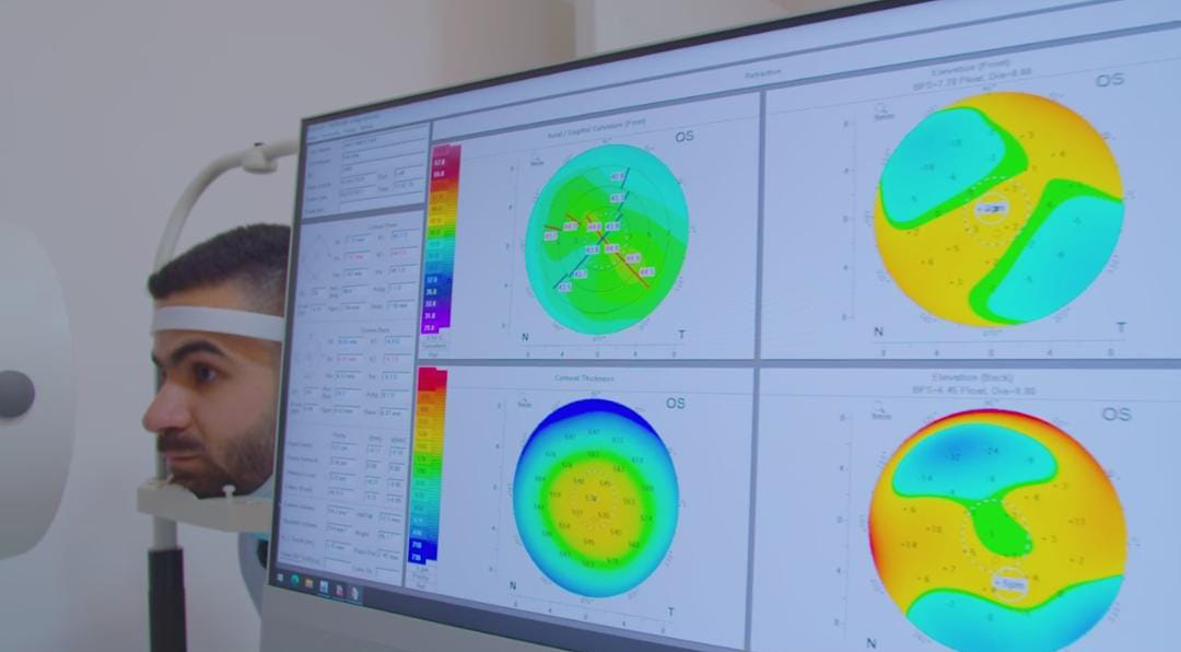 نتائج دراسات صحة العيون في الأردن