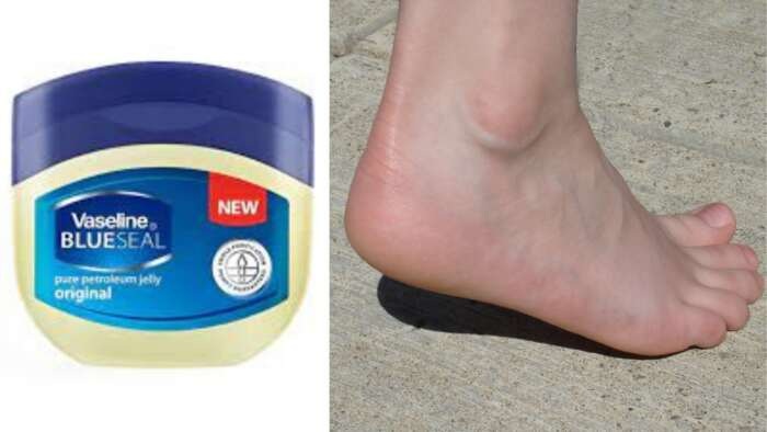 Effective Vaseline Solutions for Cracked Heels