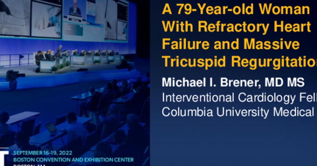 New Procedures for Individual Case Settlements