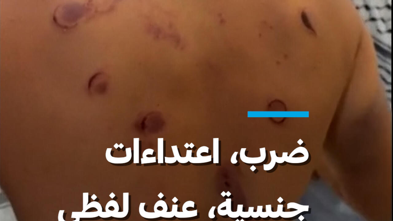 شهادات نشطاء أسطول الصمود حول الاعتداءات في تركيا