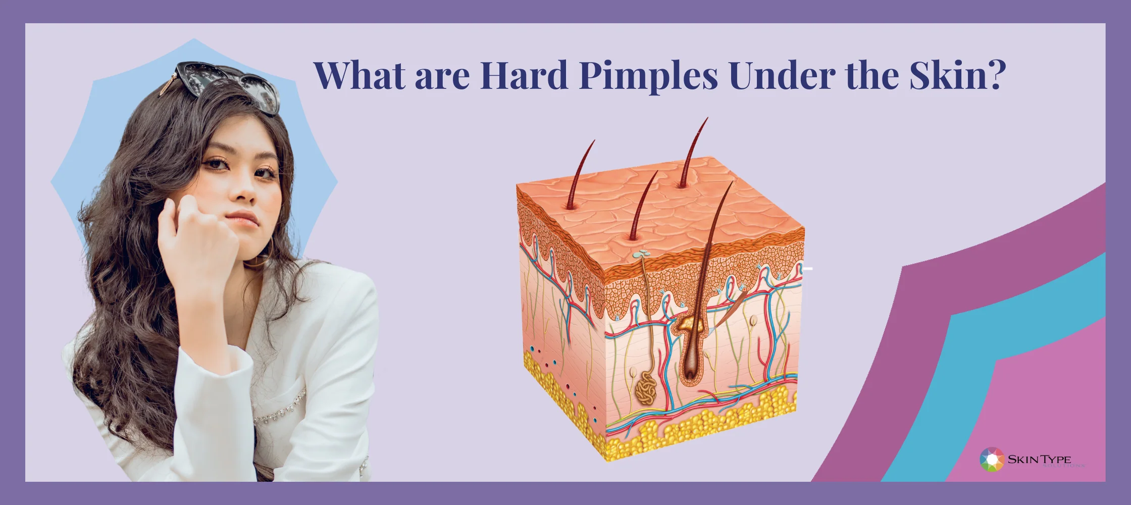 كريمات لعلاج الحبوب تحت الجلد: نصائح من محمد الناظر