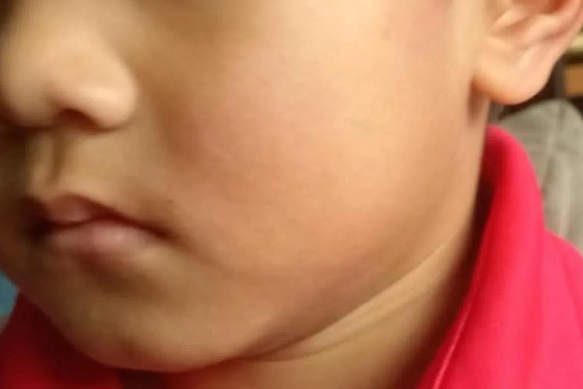 اعتداء على طفل في وودلاندز: تفاصيل الحادث