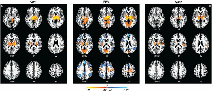 تأثير النوم والعمر على نشاط الدماغ