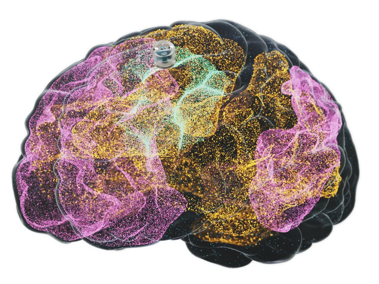 جهاز دماغي جديد لعلاج الاكتئاب