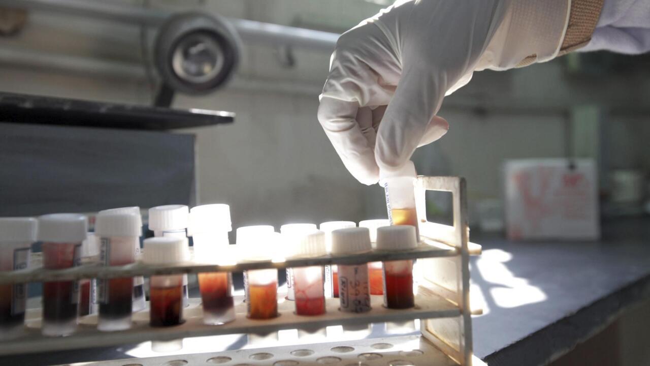 New Blood Test for Colon and Rectal Cancer Detection