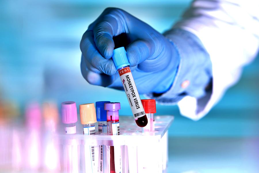 Ende des Monkeypox-Ausbruchs in Kongo