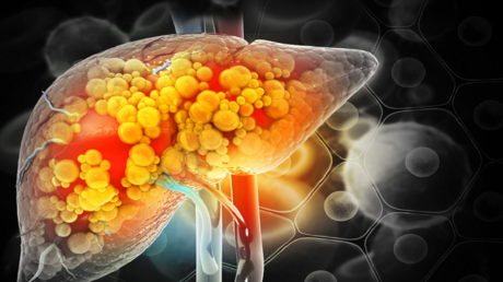 Drinking Habits and Their Impact on Liver Health