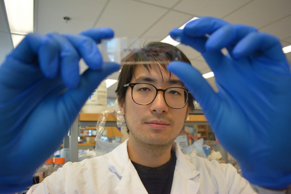 اختراق علمي جديد في علاج مرض كرون