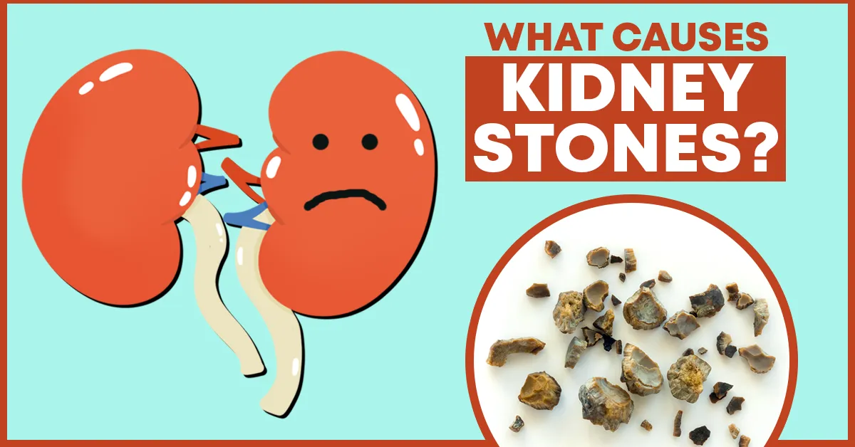 Causes of Kidney Stones: Spinach Overconsumption and More
