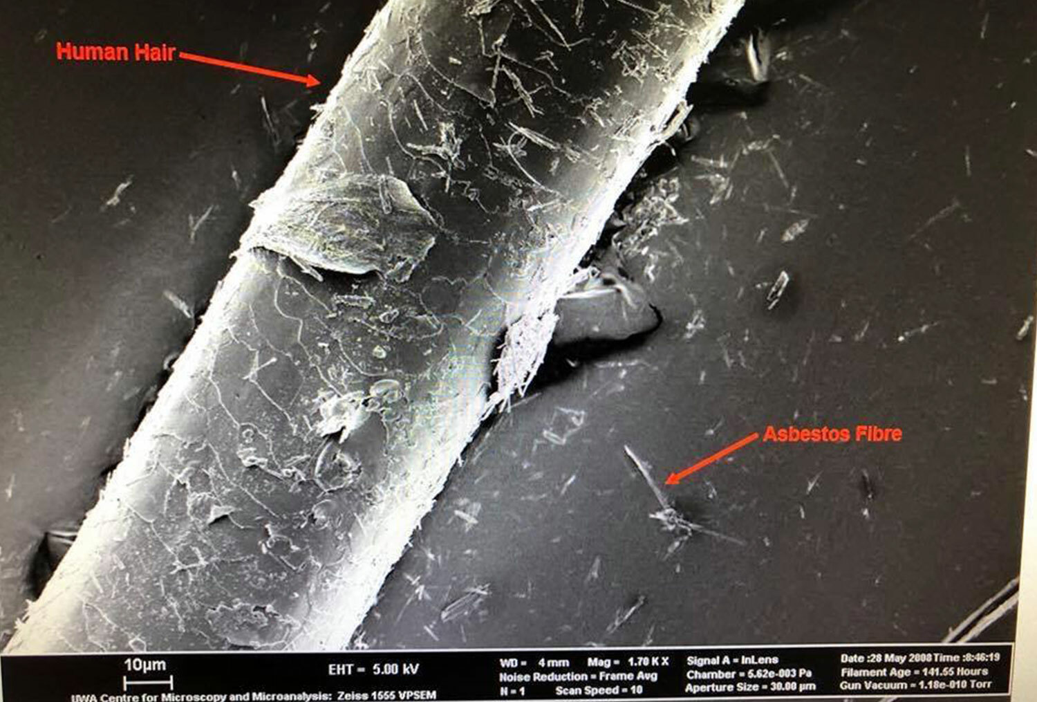 Dangers of Asbestos and Pesticides to Infants