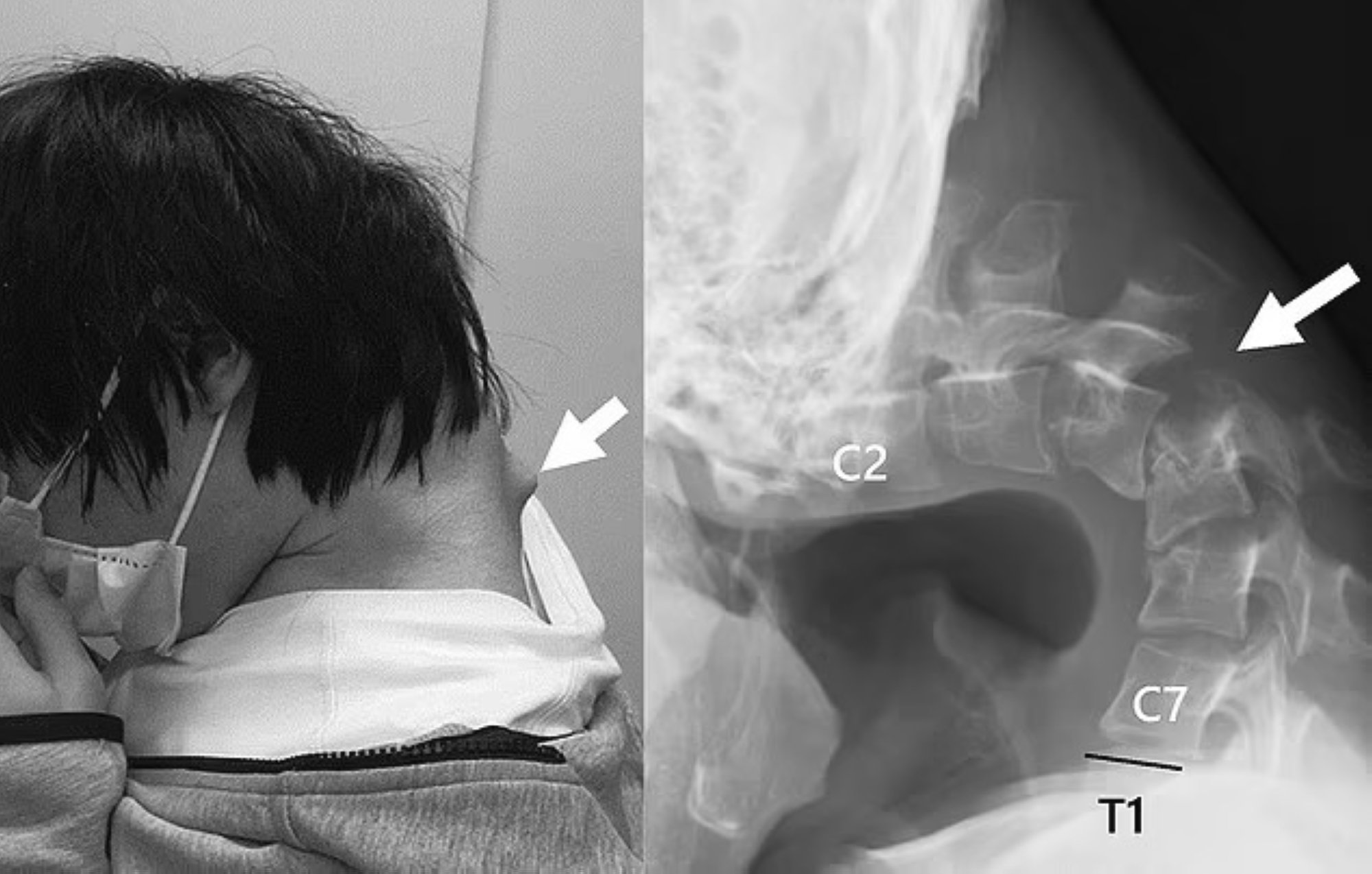 Alerte sur les risques des marchés privés