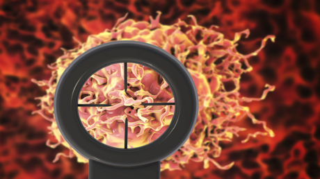 فوائد 'ميتفورمين' لمرضى سرطان البروستات